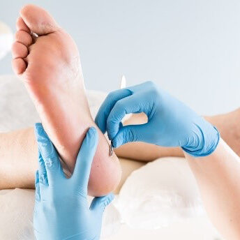 corn-callus-debridement